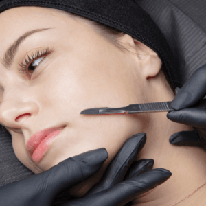 Dermaplaning in New York