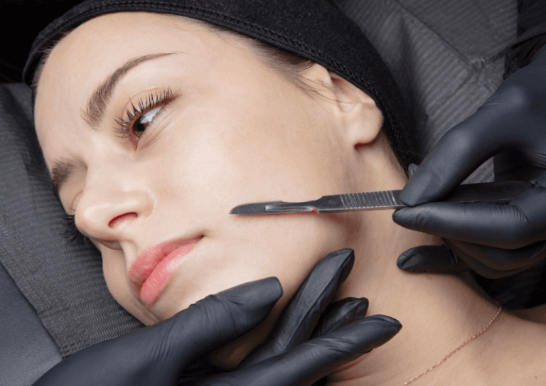 Dermaplaning in New York