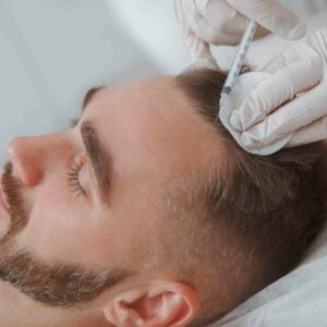 hair restoration in New York City