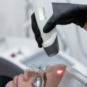 Laser Genesis Treatment in New York