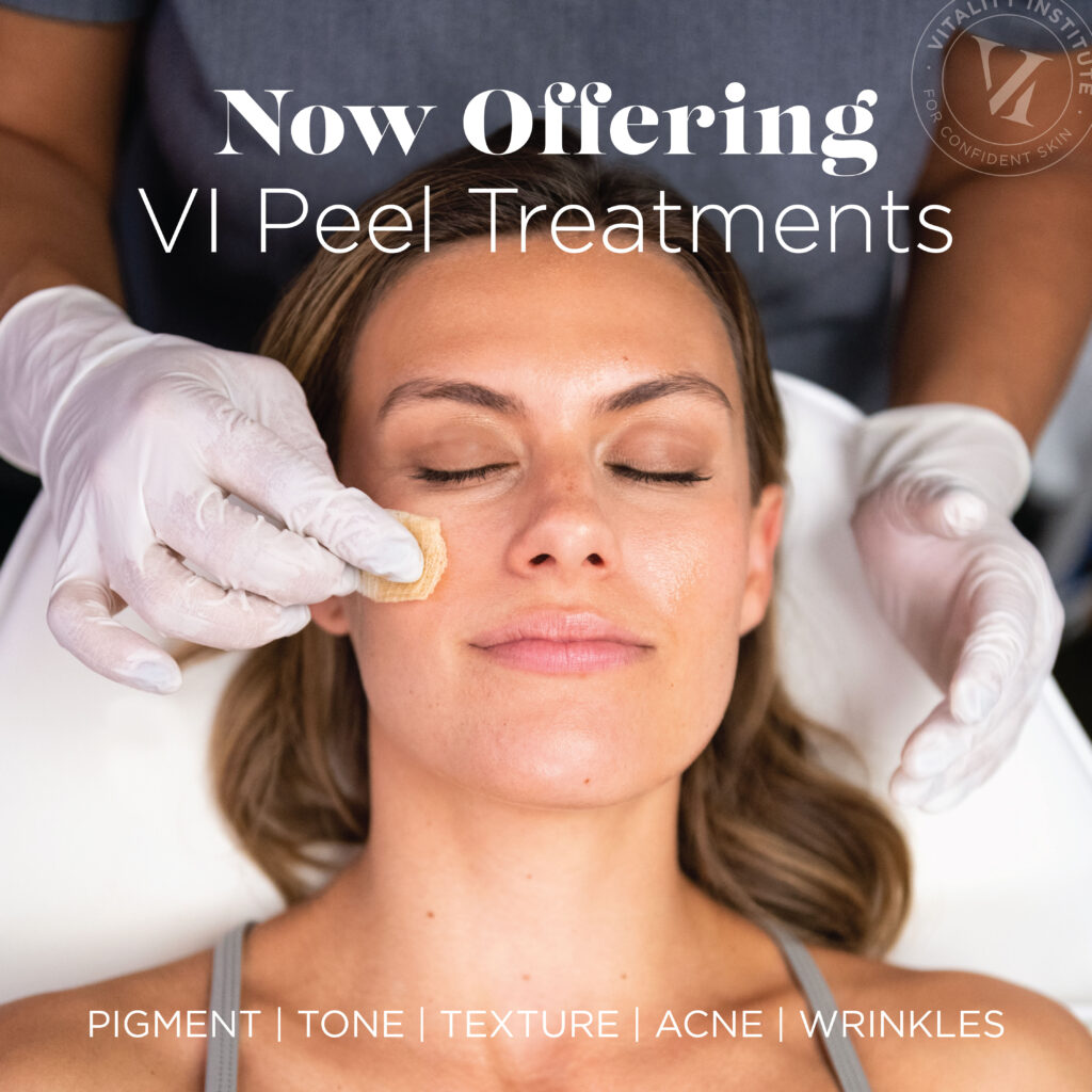 VI Peel Now Carrying